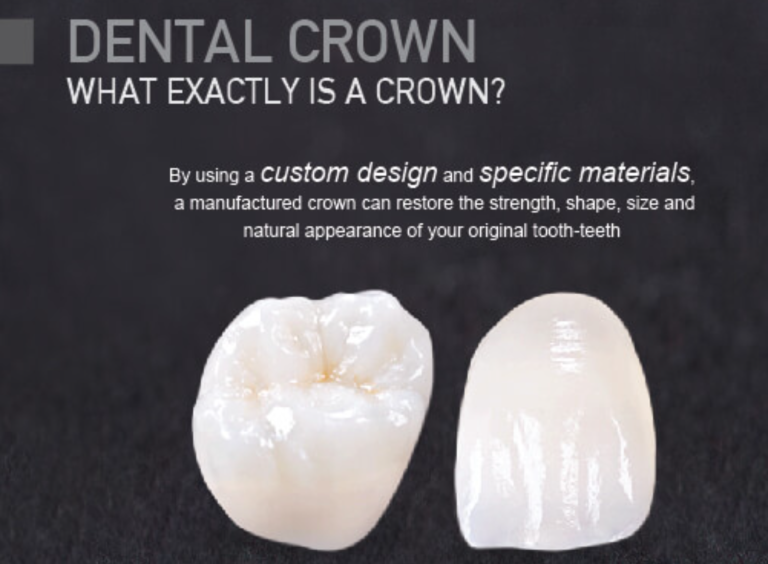 Dental Crown